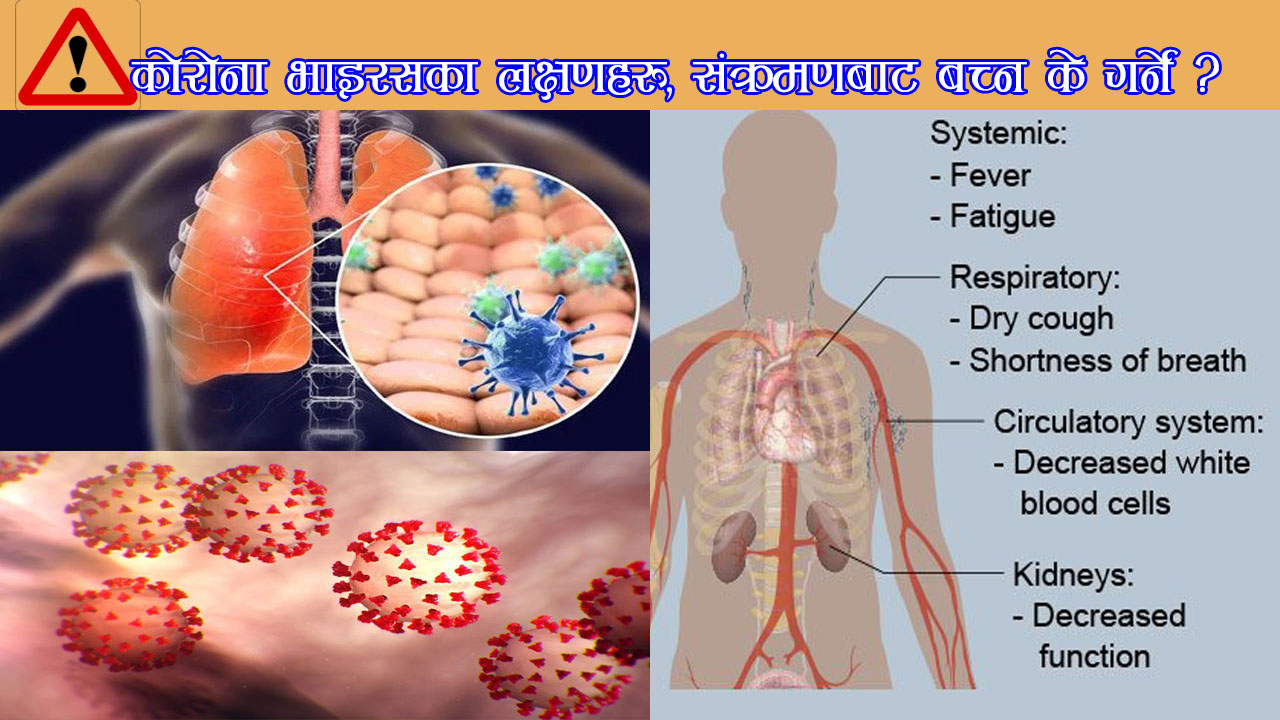 कोरोना भाइरसका लक्षणहरु, संक्रमणबाट बच्न के गर्ने ?