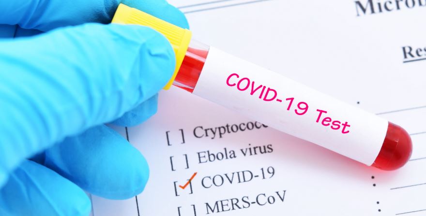 पोखराकी ५५ वर्षीया महिलामा र्‍यापिड टेष्ट गर्दा कोरोना पोजेटिभ