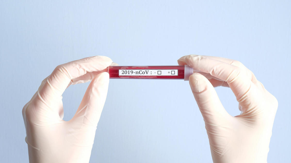 सुदूरपश्चिममा थप तीन जनामा कोरोना संक्रमणको पुष्टि