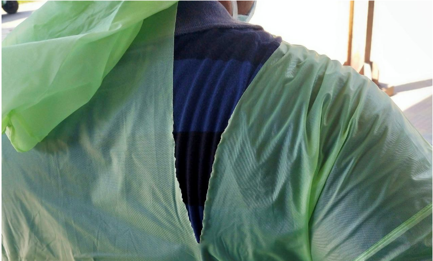 भारतमा पीपीईको अभावमा रेनकोट र हेल्मेट लगाउँछन् चिकित्सक