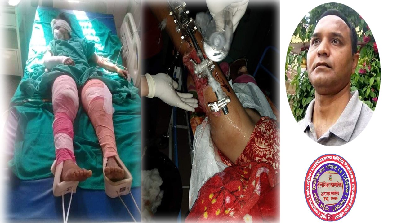 ट्रमा सेन्टरमा उपचाररत जयन्तीको अप्रेसनका लागि केशर भण्डारीले गरे सहजीकरण