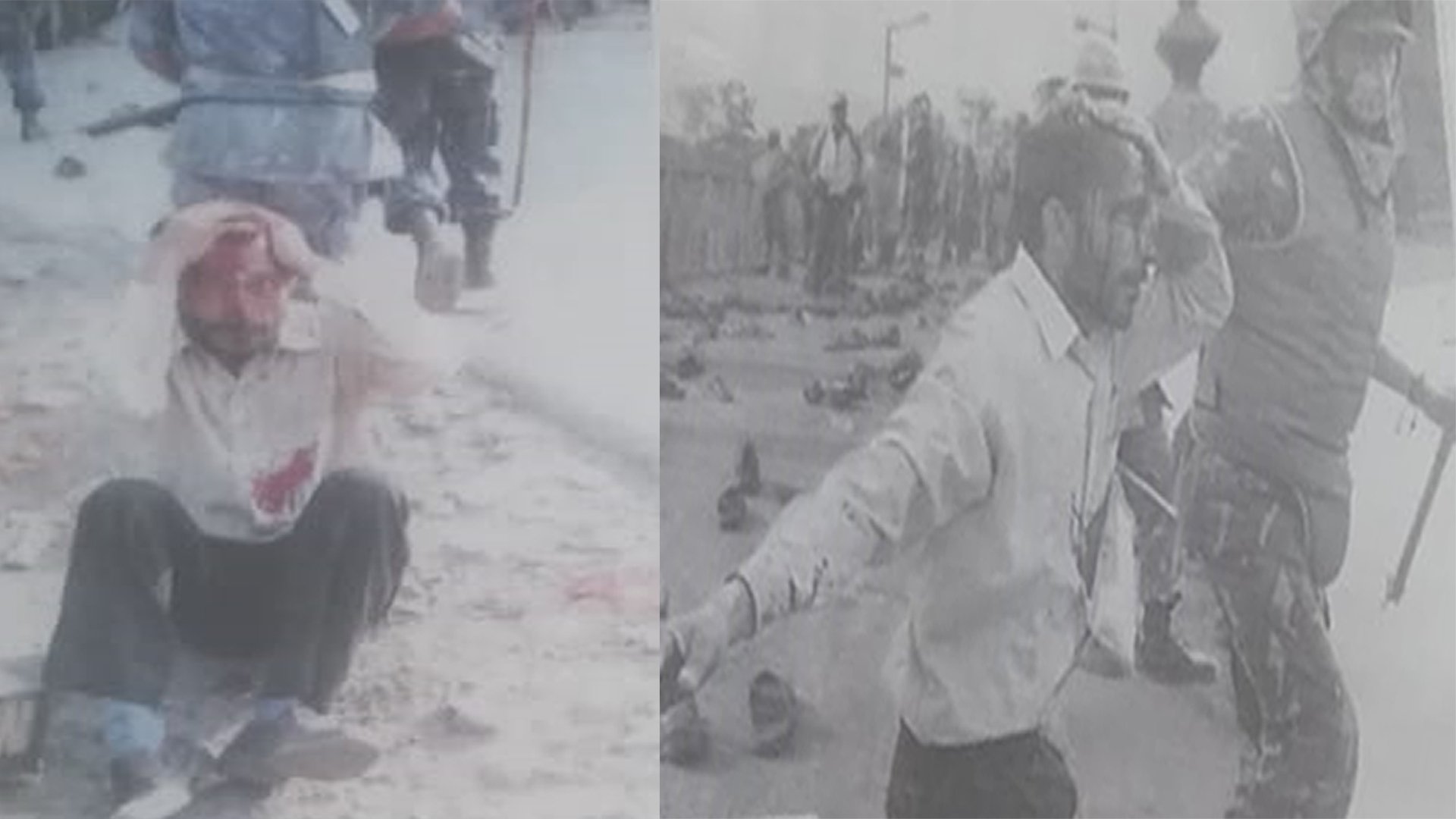 जनआन्दोलनमा गोली लागेर आँखाको दृष्टि गुमाएका बैतडीका भाटलाई काँग्रेसले न्याय गरेन