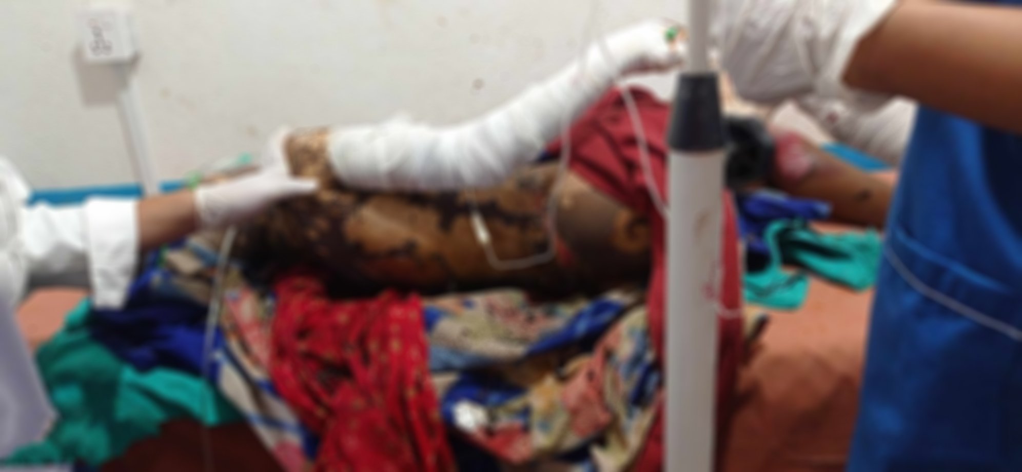 आफैमाथि मट्टीतेल छर्केर  आत्मदाहको प्रयास गरेकी दार्चुलाकी सुनाको मृत्यु